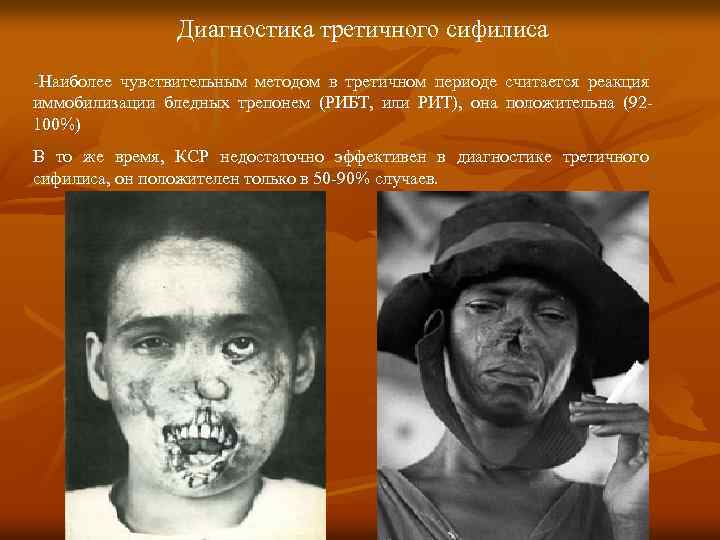 Диагностика третичного сифилиса -Наиболее чувствительным методом в третичном периоде считается реакция иммобилизации бледных трепонем