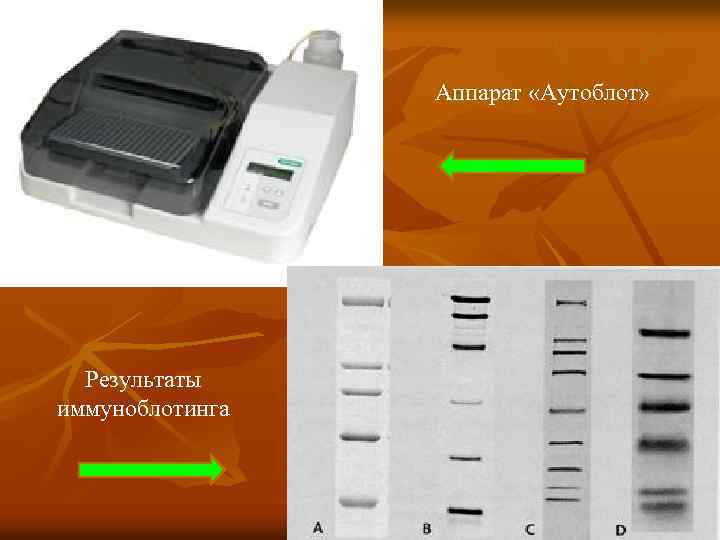 Аппарат «Аутоблот» Результаты иммуноблотинга 