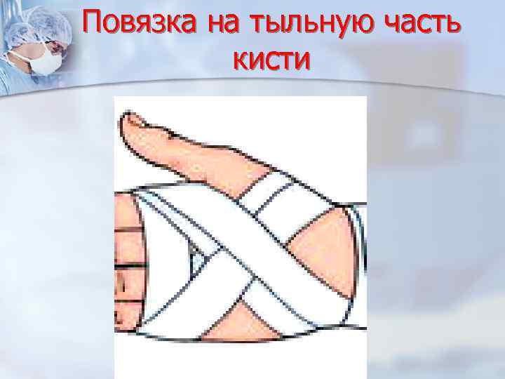 Повязка на тыльную часть кисти 
