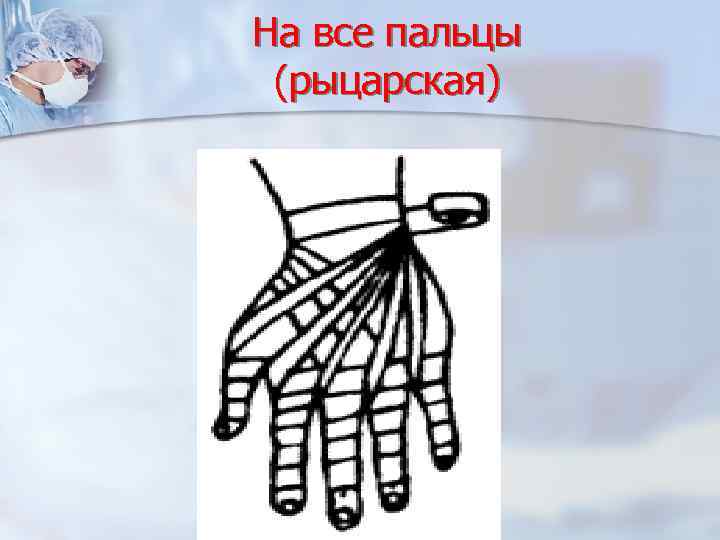 На все пальцы (рыцарская) 