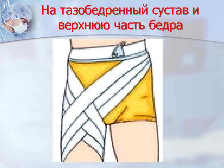 На тазобедренный сустав и верхнюю часть бедра 