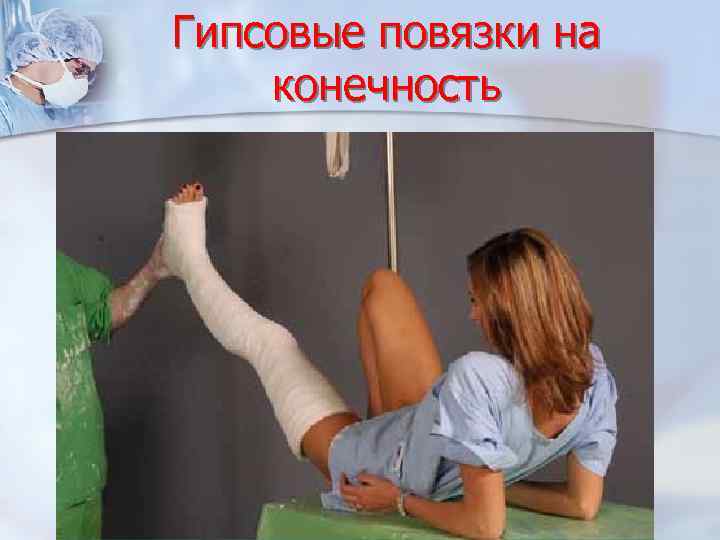 Гипсовые повязки на конечность 