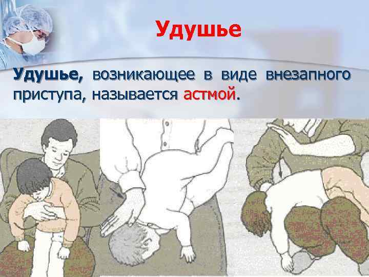 Удушье, возникающее в виде внезапного приступа, называется астмой. 