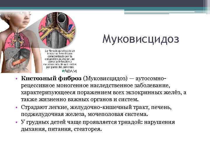Муковисцидоз • Кистозный фиброз (Муковисцидоз) — аутосомно рецессивное моногенное наследственное заболевание, характеризующееся поражением всех