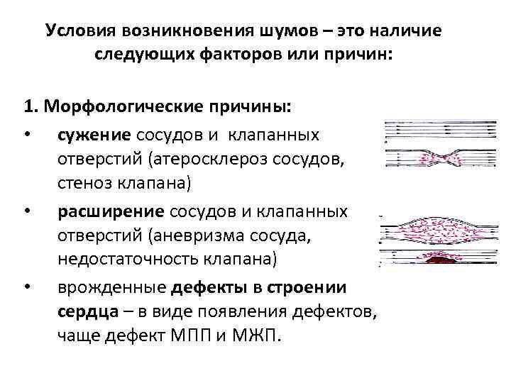 Условия возникновения шумов – это наличие следующих факторов или причин: 1. Морфологические причины: •