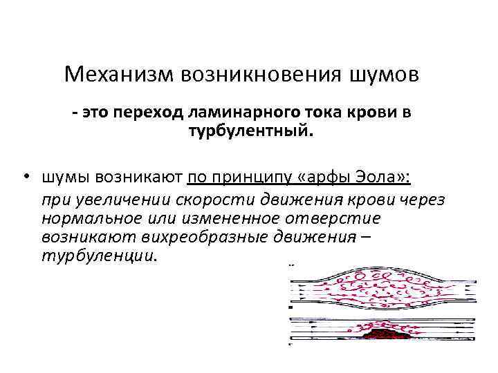 Механизм возникновения шумов - это переход ламинарного тока крови в турбулентный. • шумы возникают
