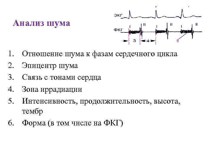 Анализ шума 1. 2. 3. 4. 5. Отношение шума к фазам сердечного цикла Эпицентр