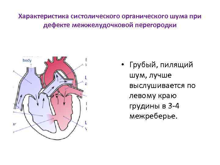 Характеристика систолического органического шума при дефекте межжелудочковой перегородки • Грубый, пилящий шум, лучше выслушивается