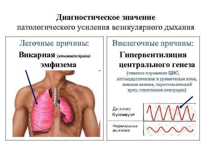 Дыхание чистое везикулярное. Компенсаторная эмфизема. Компенсаторная эмфизема легких. Патологическое усиление везикулярного дыхания. Викарная эмфизема лёгких что это.