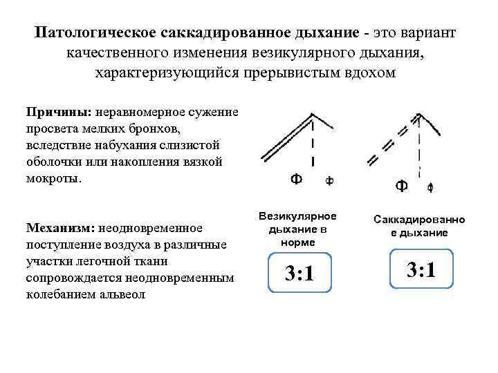 Везикулярное дыхание это норма