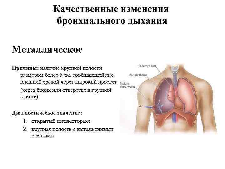 Почему наличие. Бронхиальное дыхание при патологии. Патология бронхиального дыхания. Механизм образования патологического бронхиального дыхания. Причины бронхиального дыхания.