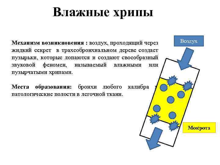 Влажные хрипы Механизм возникновения : воздух, проходящий через жидкий секрет в трахеобронхиальном дереве создает