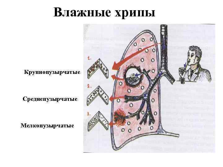 Почему легкие влажные