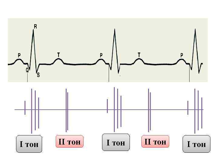 I тон II тон 