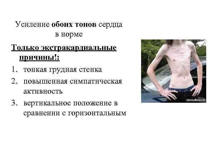Усиление обоих тонов сердца в норме Только экстракардиальные причины!: 1. тонкая грудная стенка 2.