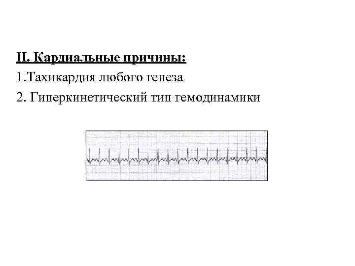 II. Кардиальные причины: 1. Тахикардия любого генеза 2. Гиперкинетический тип гемодинамики 