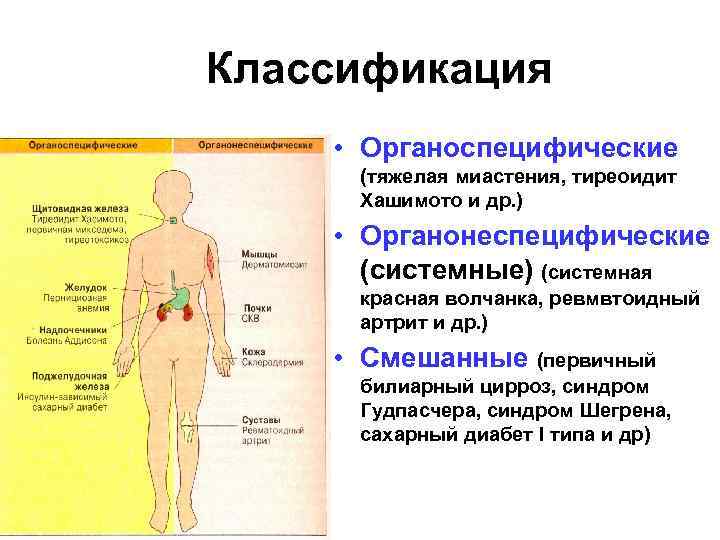 Аутоиммунный тиреоидит клиническая картина