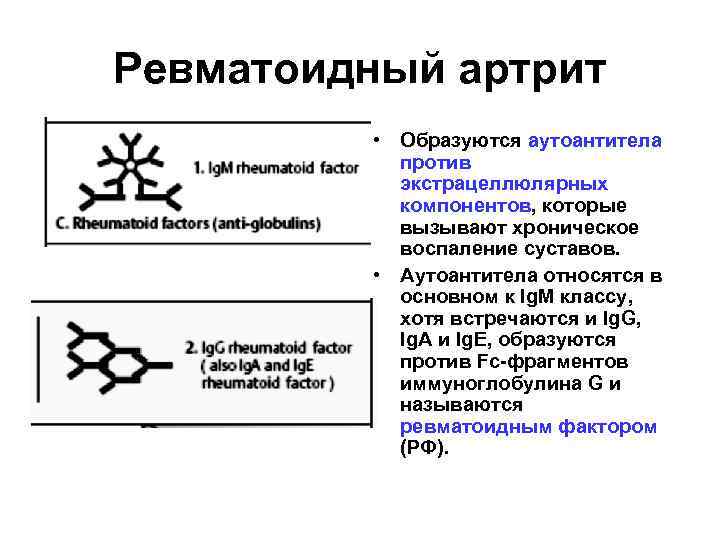 Ревматоидный артрит • Образуются аутоантитела против экстрацеллюлярных компонентов, которые вызывают хроническое воспаление суставов. •