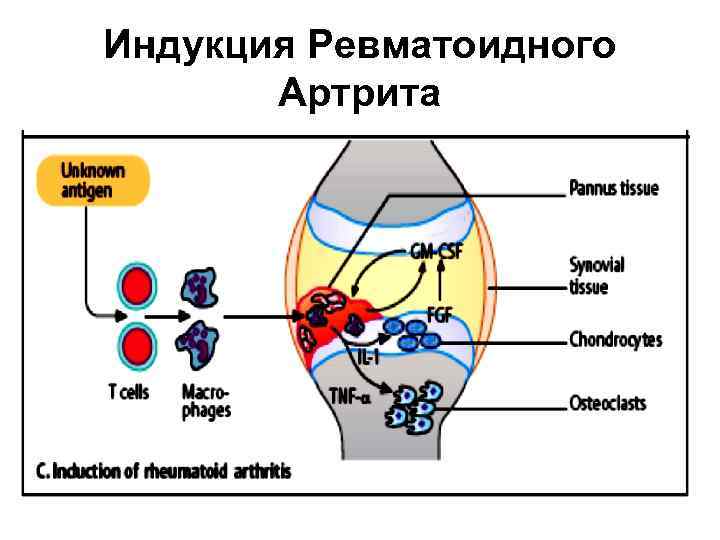 Схема аутоиммунной реакции