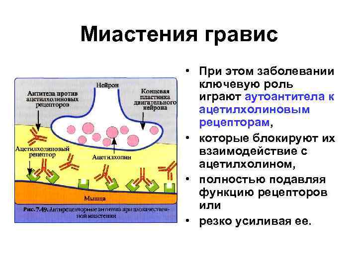 Миастения гравис • При этом заболевании ключевую роль играют аутоантитела к ацетилхолиновым рецепторам, •