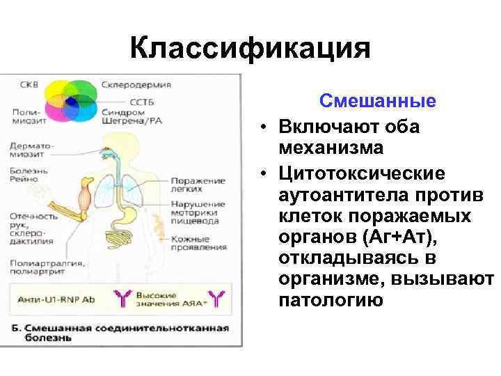 Классификация Смешанные • Включают оба механизма • Цитотоксические аутоантитела против клеток поражаемых органов (Аг+Ат),