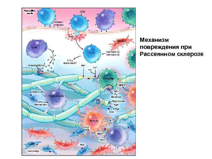 Механизм повреждения при Рассеянном склерозе 