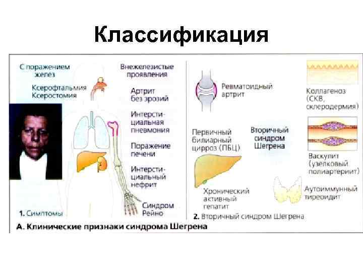 Классификация 