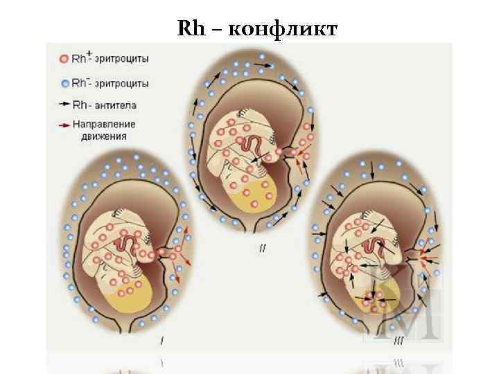 Rh – конфликт 