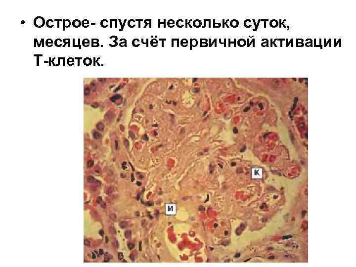  • Острое- спустя несколько суток, месяцев. За счёт первичной активации Т-клеток. 