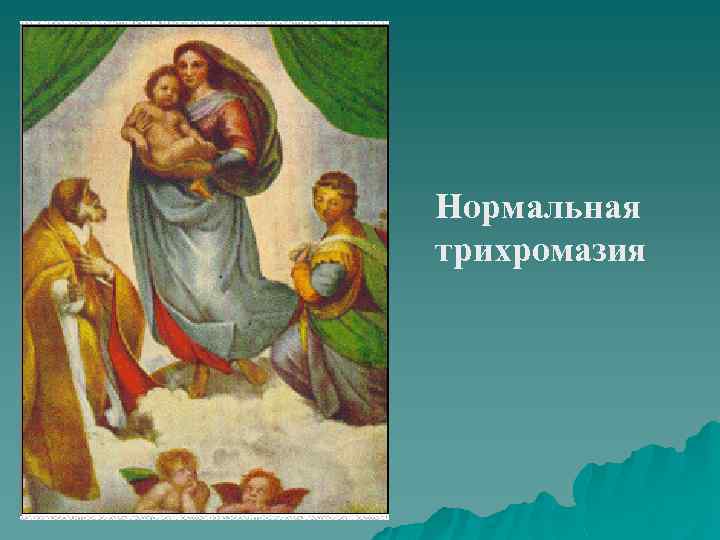 Нормальная трихромазия 