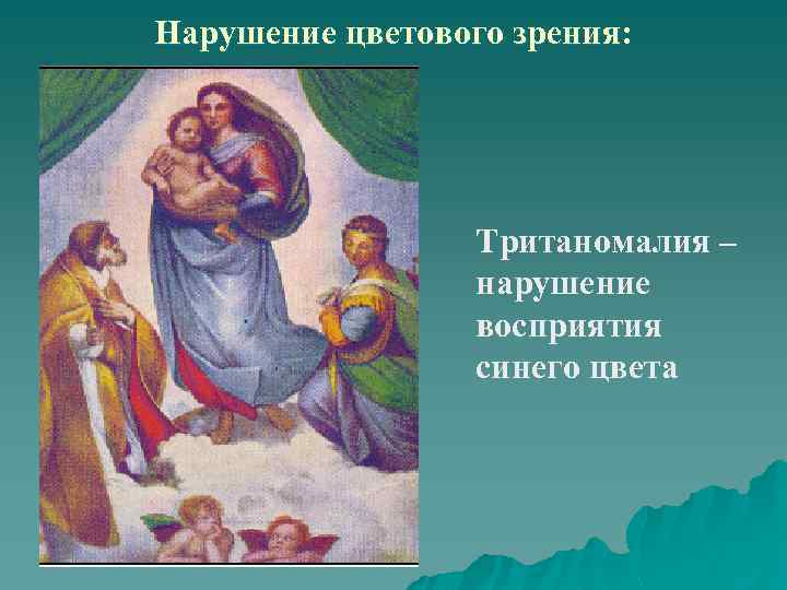 Нарушение цветового зрения: Тританомалия – нарушение восприятия синего цвета 