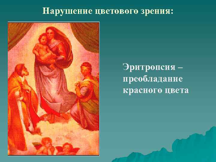 Нарушение цветового зрения: Эритропсия – преобладание красного цвета 