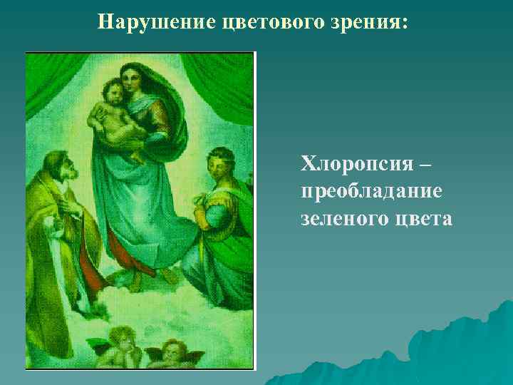Нарушение цветового зрения: Хлоропсия – преобладание зеленого цвета 