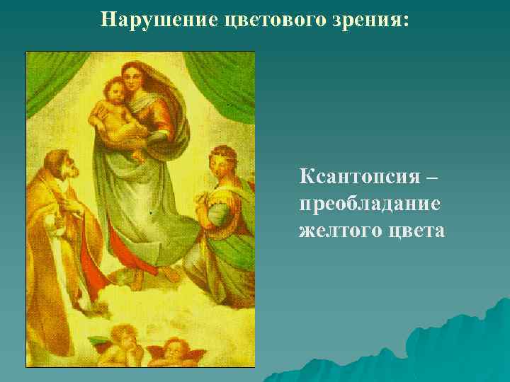 Нарушение цветового зрения: Ксантопсия – преобладание желтого цвета 