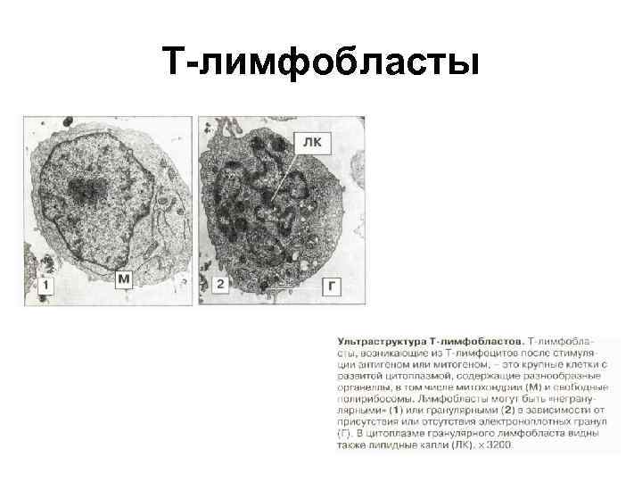 Т-лимфобласты 