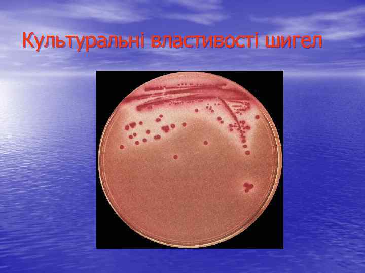 Культуральні властивості шигел 