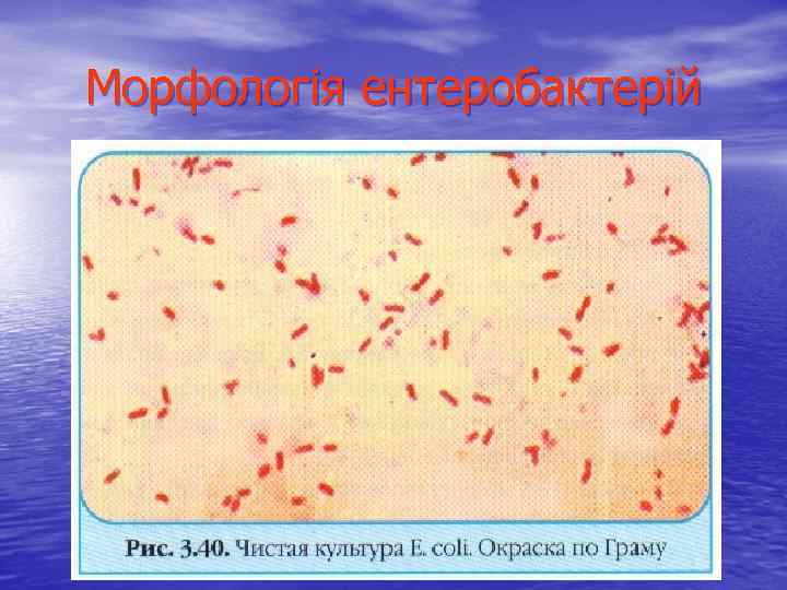 Морфологія ентеробактерій 