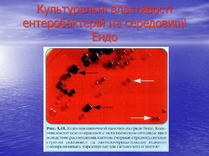 Культуральні властивості ентеробактерій на середовищі Ендо 