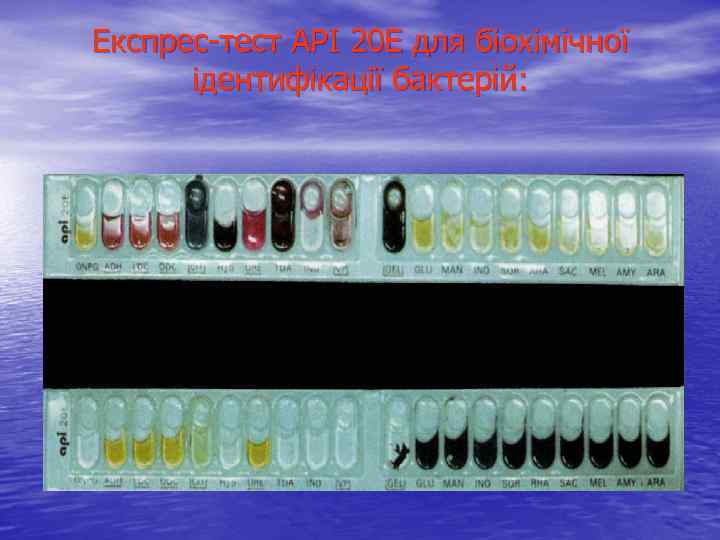 Експрес-тест API 20 E для біохімічної ідентифікації бактерій: 