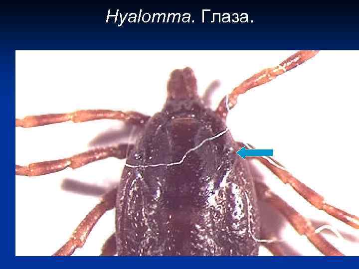 Hyalomma. Глаза. 