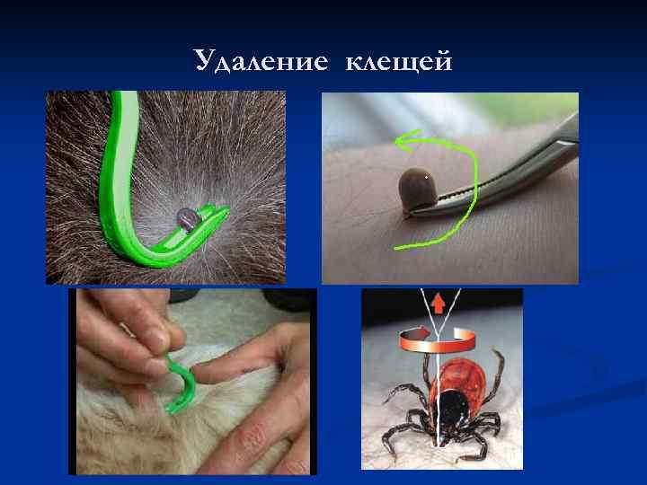 Удаление клещей 