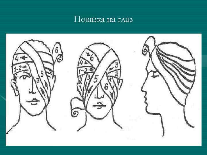 Повязка на глаз 