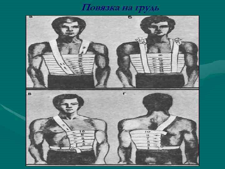 Повязка на грудь 
