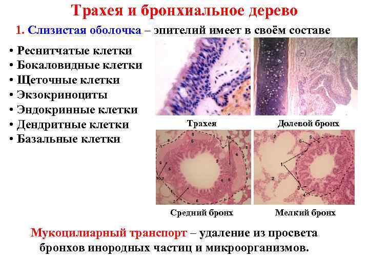 Трахею выстилает эпителий. Слизистая бронхов строение. Клетки трахеи гистология. Строение слизистой оболочки бронхов. Клетки бронхов гистология.