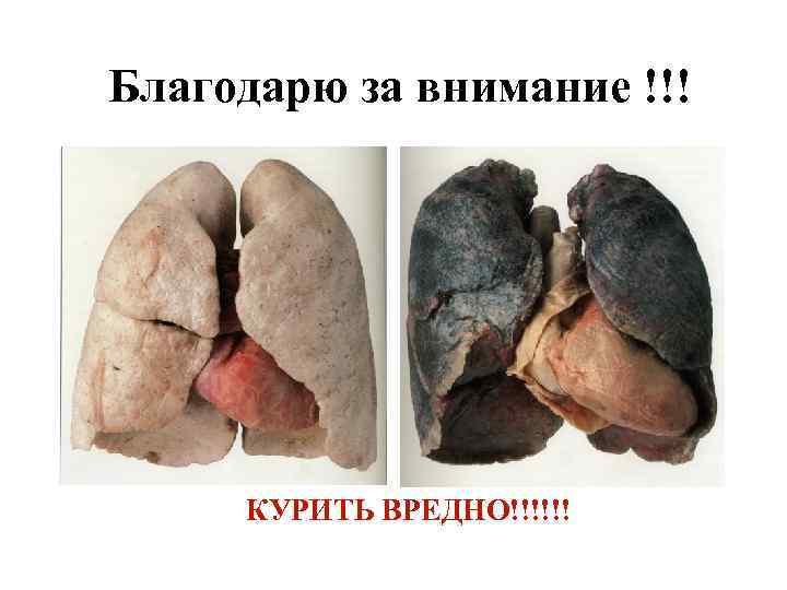 Благодарю за внимание !!! КУРИТЬ ВРЕДНО!!!!!! 