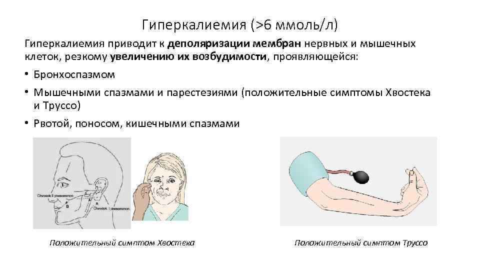 Гиперкалиемия (>6 ммоль/л) Гиперкалиемия приводит к деполяризации мембран нервных и мышечных клеток, резкому увеличению