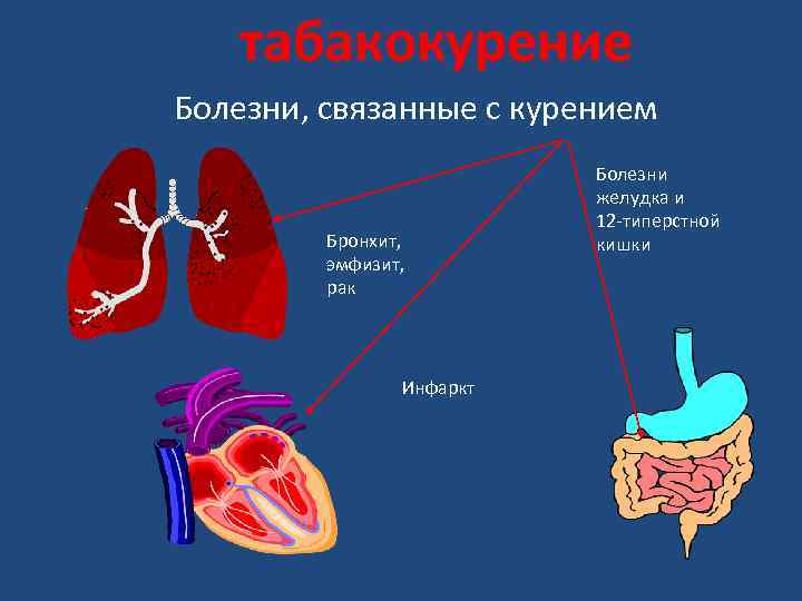 табакокурение Болезни, связанные с курением Бронхит, эмфизит, рак Инфаркт Болезни желудка и 12 -типерстной