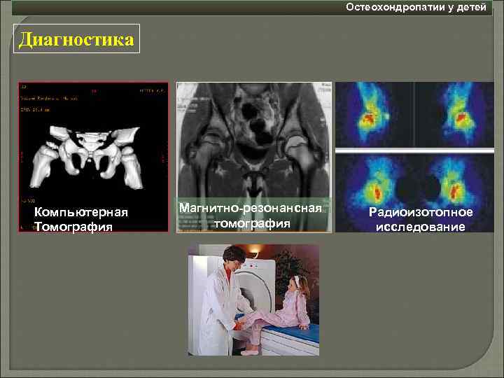 Остеохондропатии у детей Диагностика Компьютерная Томография Магнитно-резонансная томография Радиоизотопное исследование 