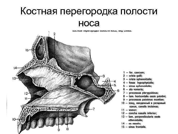 Костная перегородка полости носа 