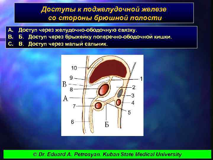 Доступы к поджелудочной железе со стороны брюшной полости A. Доступ через желудочно-ободочную связку. B.